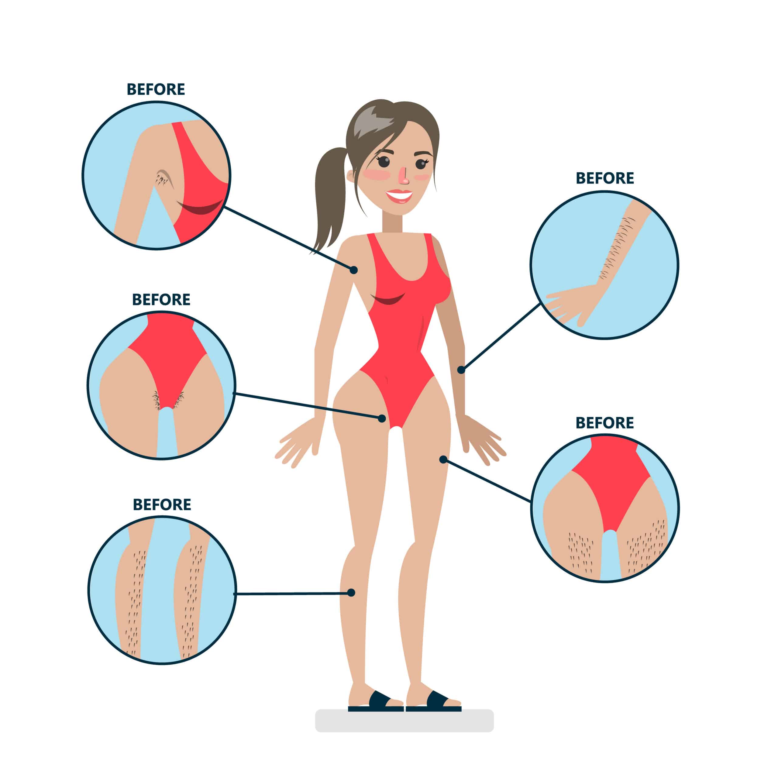 المناطق التي يمكن إزالة الشعر منها باستخدام الليزر
